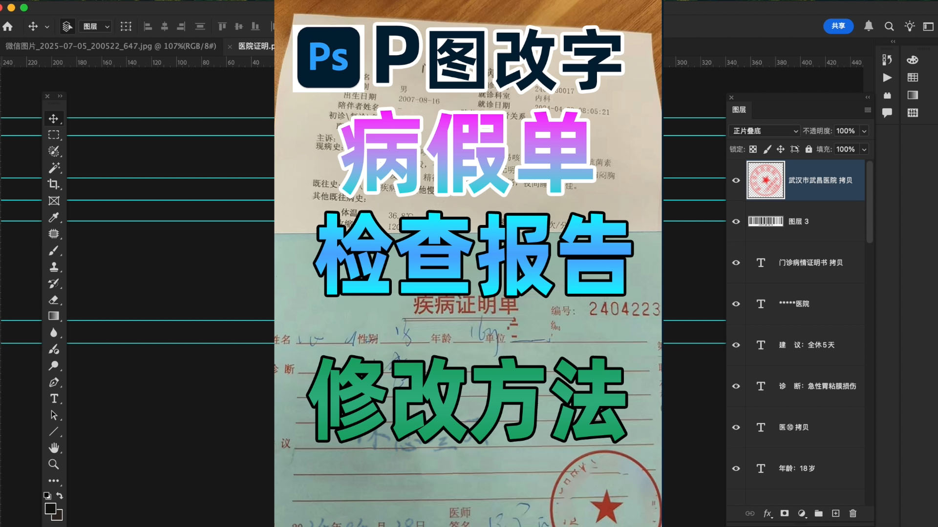 检查报告病假单图怎么P，p图改字无痕改图接单。